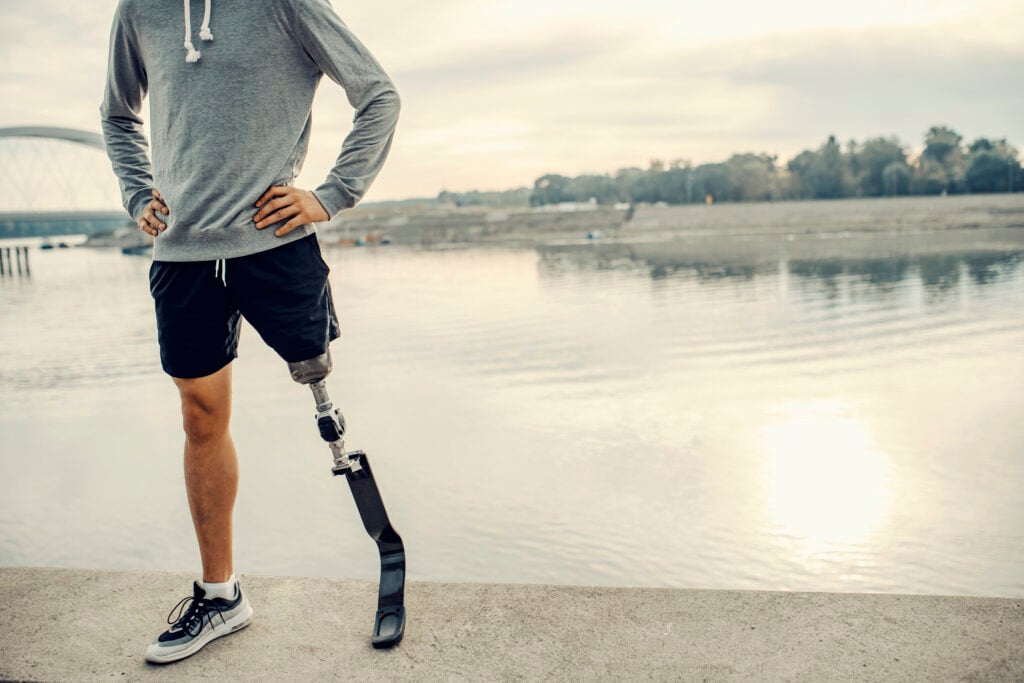 Man with prosthetic leg standing near water