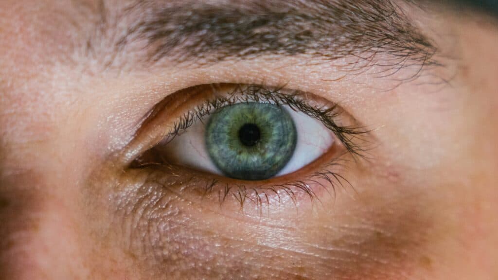 Eye Cancer