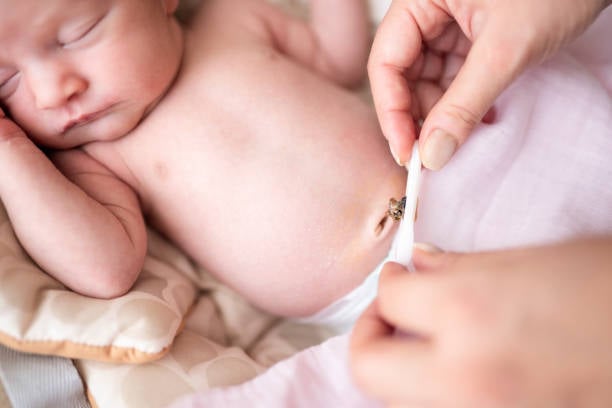 Most common umbilical cord problems