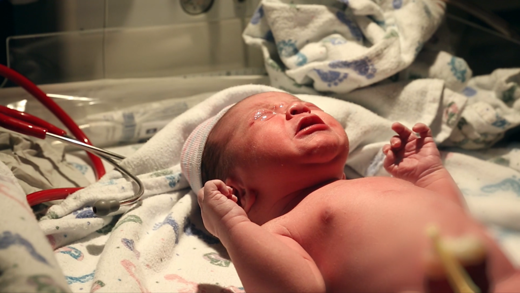 Newborn baby lying on a hospital bed, showing signs of HIE birth injury.