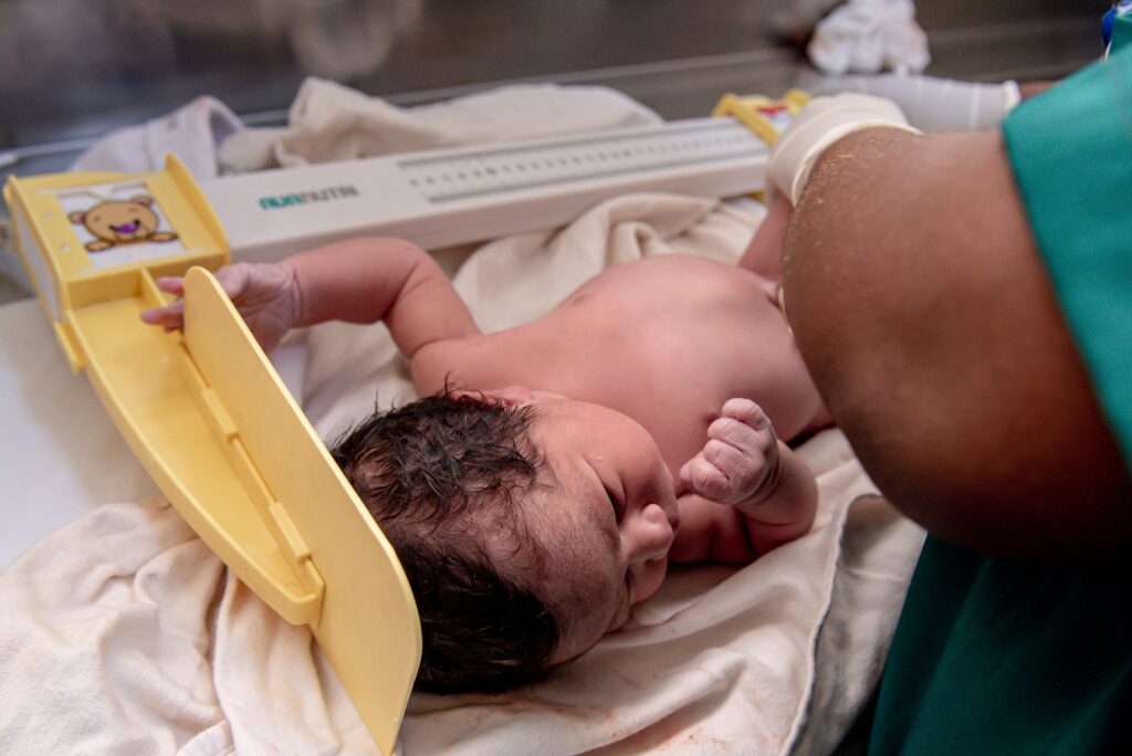Newborn examined after birth with possible Klumpke palsy injury affecting arm movement.
