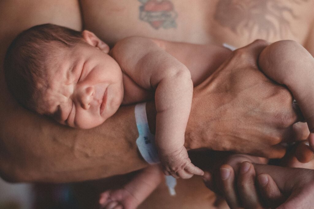 Newborn showing signs of shoulder dystocia being supported by medical hands after delivery
