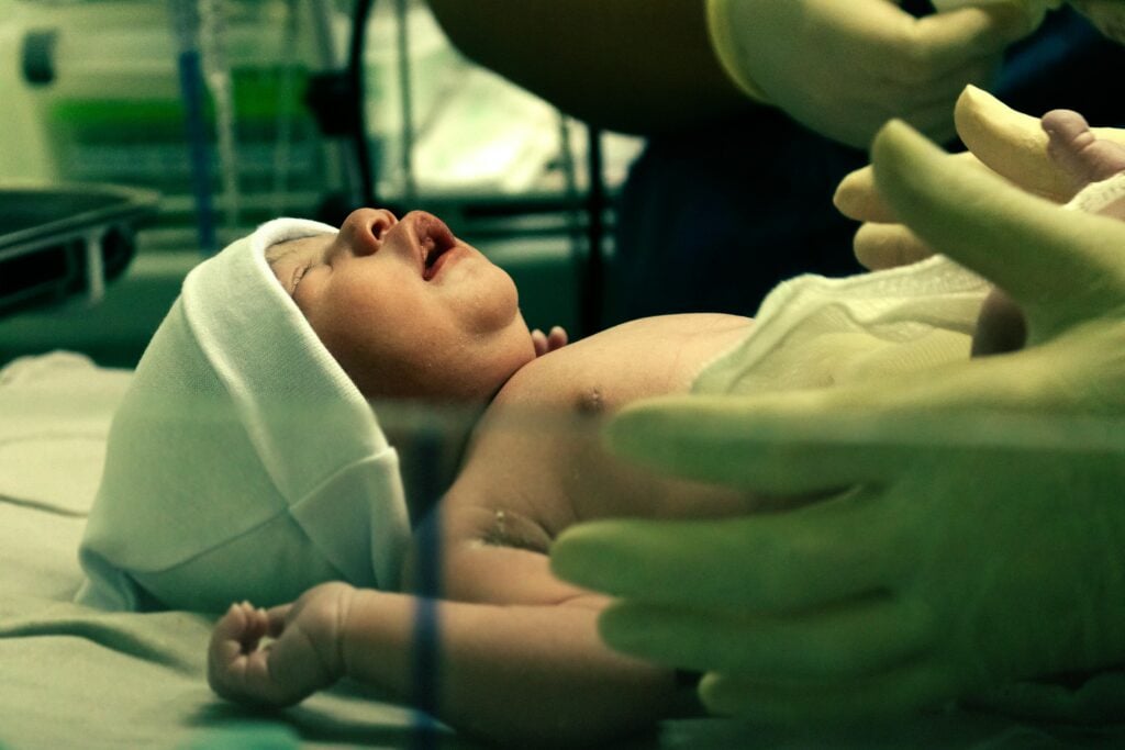 Newborn baby examined by medical staff in a hospital bed after delivery, hands visible.