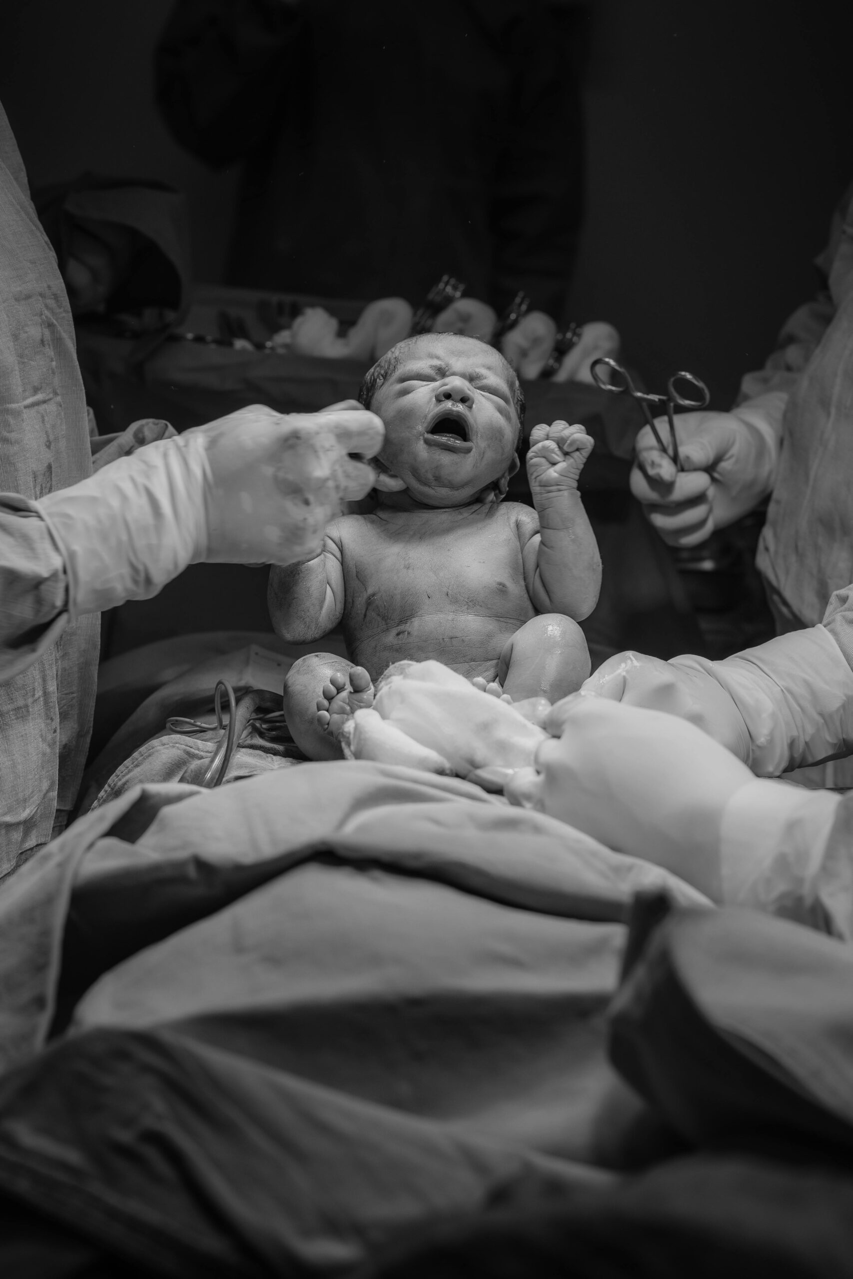 Newborn baby delivered in hospital operating room surrounded by medical staff during birth procedure.