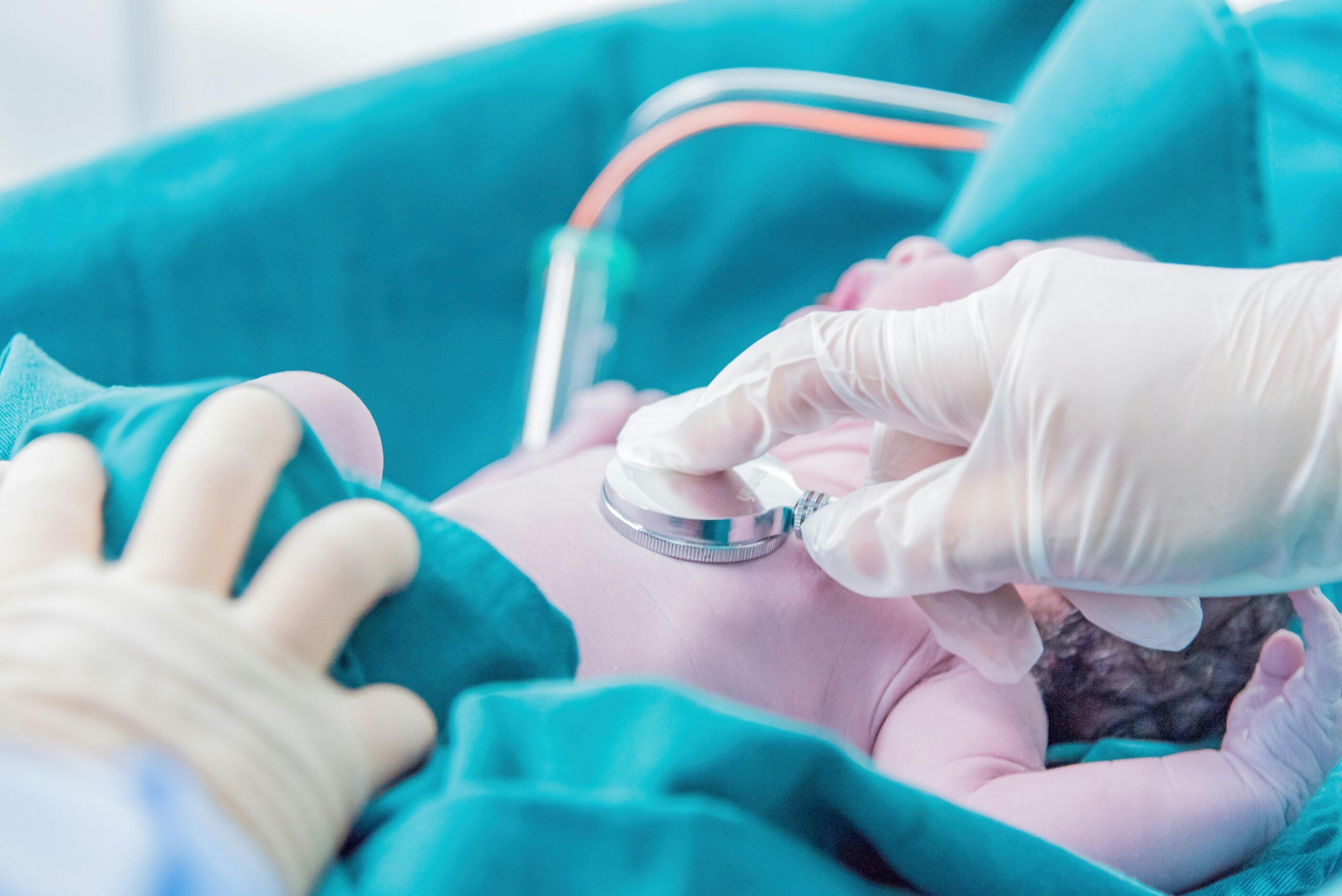 Medical team examining newborn, representing Child's Birth Injury and neonatal care complications.