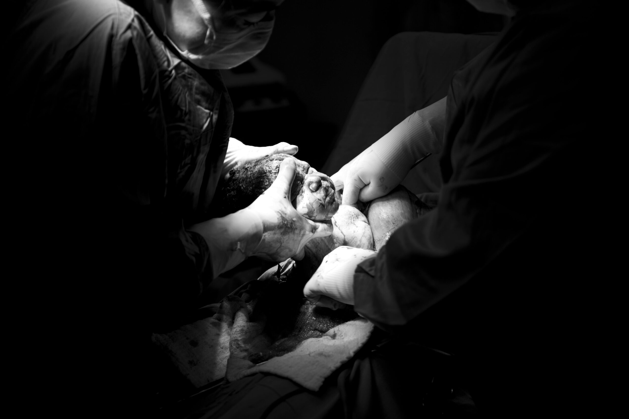 Black-and-white image of newborn delivery by doctors during birth injury procedure