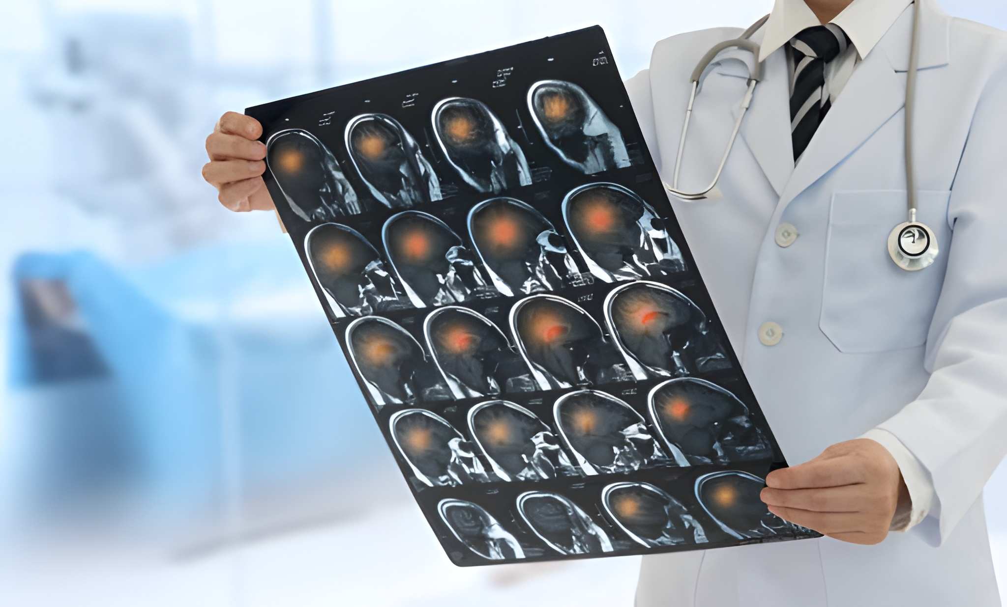 Doctor radiology or radiographer looking stroke brain x-ray image